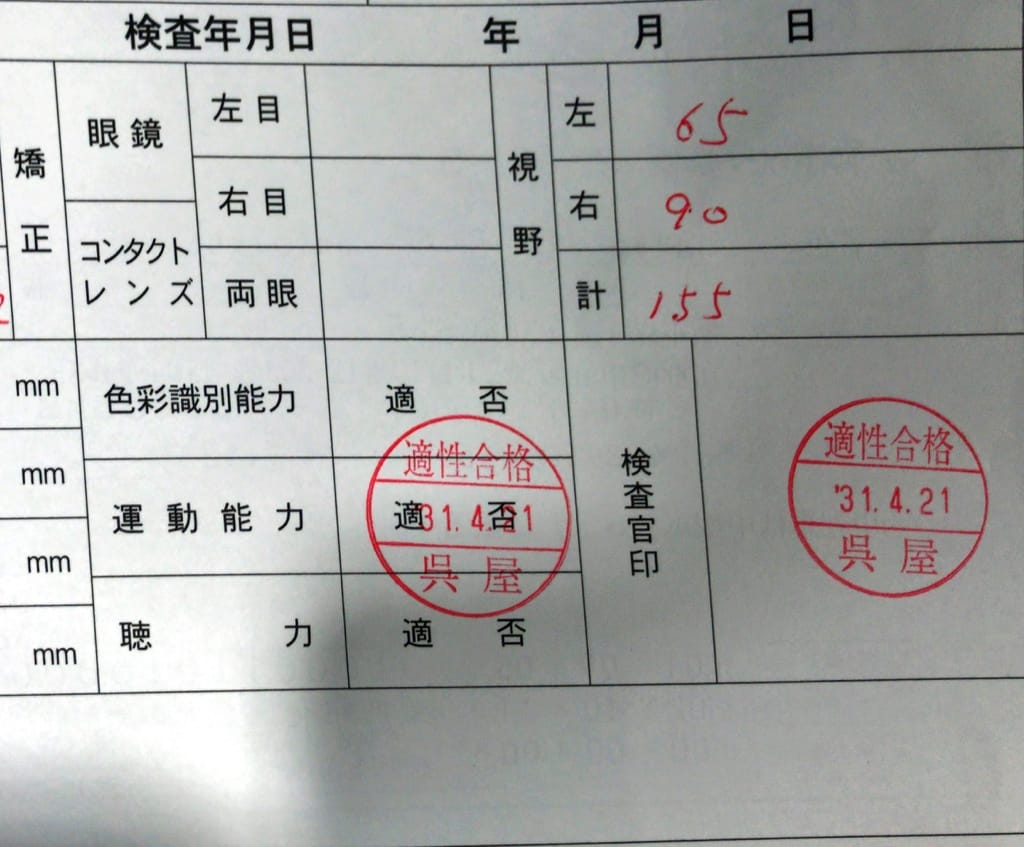 黄斑変性症の経過
